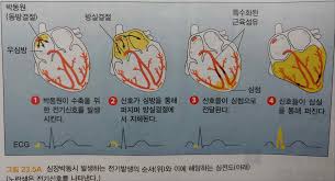 간호학 심장구조 심방심실역할 판막관상동맥 심전도계 탈분극재분극