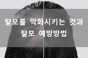  탈모예방과 탈모를 악화시키는 것