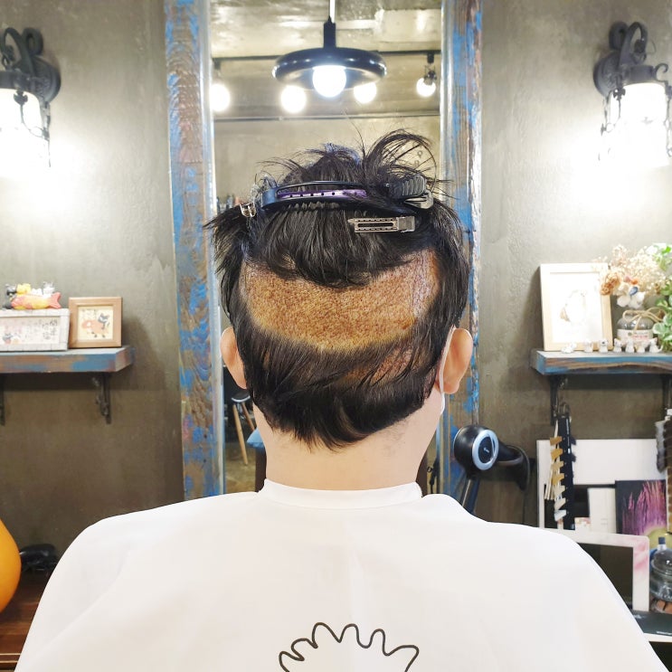  앞머리 심기 중요하지만 뒷머리 상태는?