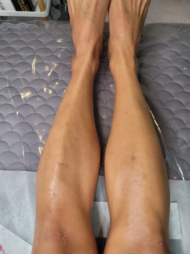  매끈한 다리의 완성. 다리털 안녕~ - 인천청라왁싱, 블레스토탈뷰티 왁싱
