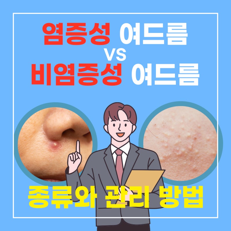 여드름 압출 후에는 사후관리가 필수적입니다 5