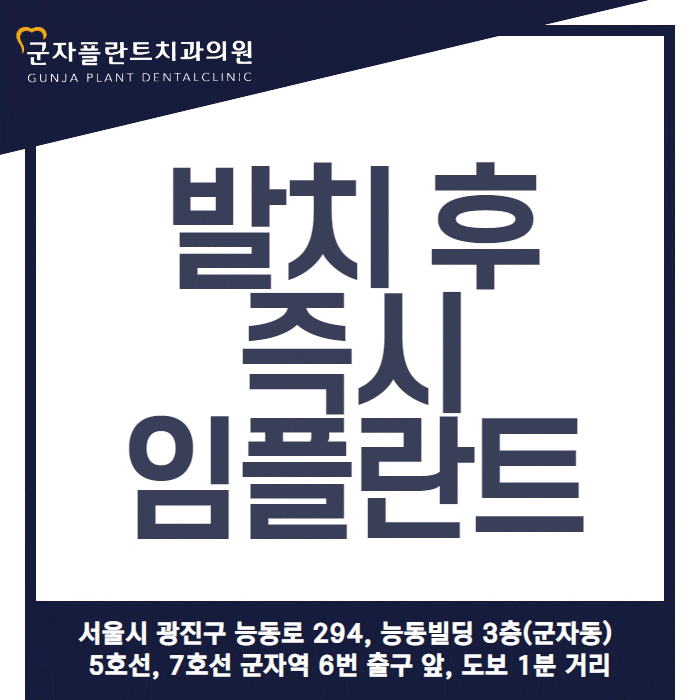 면목역임플란트, 치과에서 전해 드리는 임플란트 정보 체크 면목역임플란트, 치과에서 전해 드리는 임플란트 정보 체크
