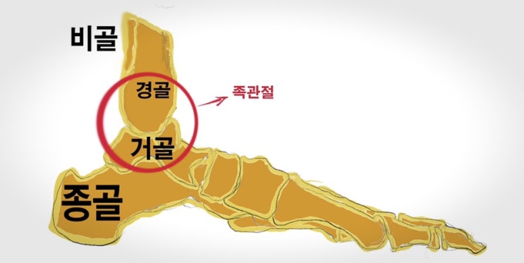  [후유장해]족관절 장해 - 보상과 배상은?