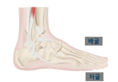  보행 중에 자꾸 발이 걸려 넘어집니다. - 족하수 - 안양
