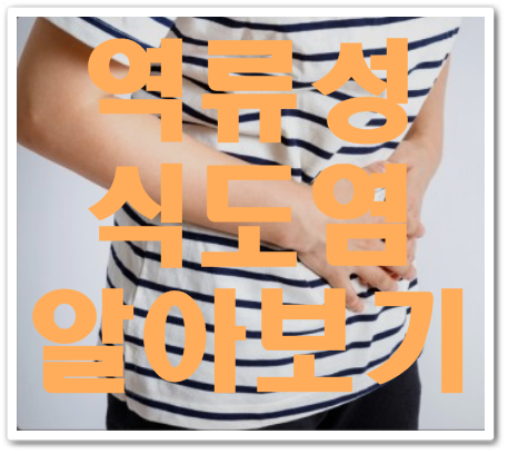  스토가정 10mg 역류성 식도염에 효과적이에요.