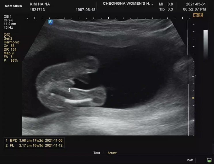  6월 01일) 17w2d 오늘의 일기. 성별 두둥/조리원예약