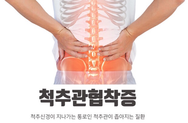  척추관협착증｜허리디스크와 증상이 반대?
