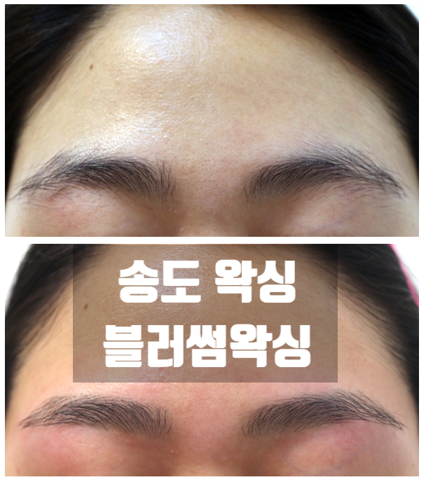  송도왁싱 센트럴파크 블러썸왁싱 눈썹 팔 겨드랑이 왁싱 깔끔하다