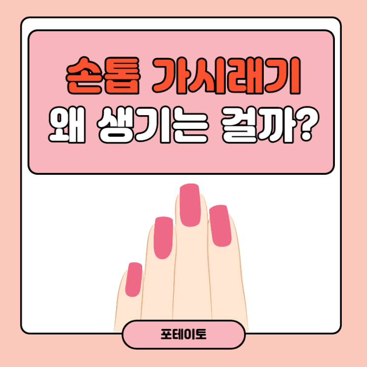  손톱 가시래기, 왜 생기는 걸까?