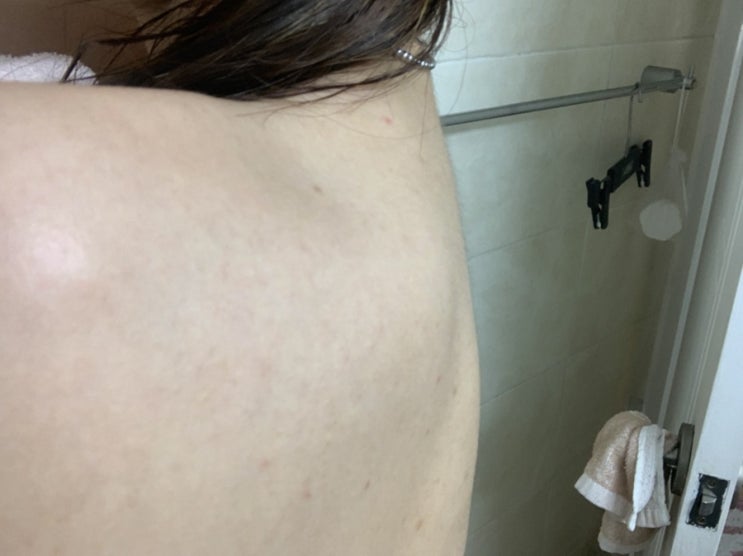  몸트러블엔  등드름미스트 [밀크바오밥] 클리어 바디미스트 찐후기