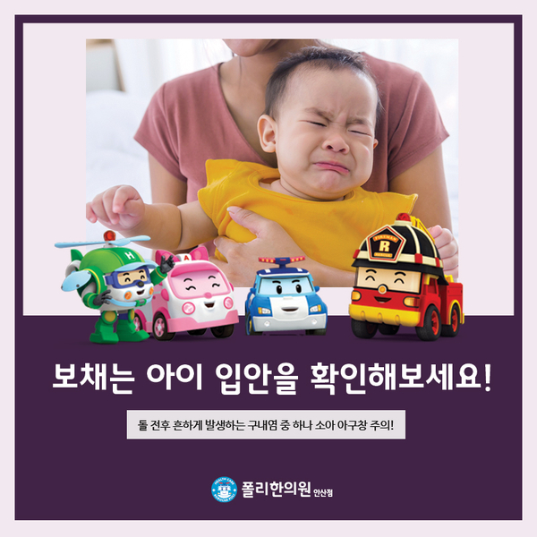 소아 아구창, 이유 없이 울고 보챈다면 입 안을 확인하세요!
