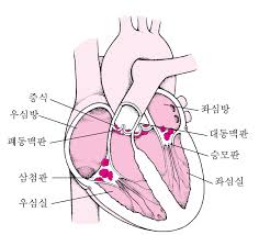심장공부 심도자술간호 관상동맥조영술 심전도12유도법 양극단극유도