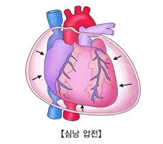 간호학 심장효소종류검사 심근경색진단 포타슘칼륨 ABGA전혈구검사 심장장애질환