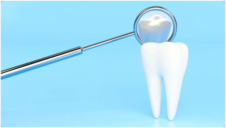 치아 금감 치료? 섣불리 치료받지 마세요.