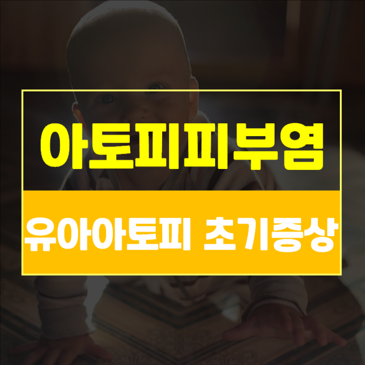  아기태열이 아토피로? 신생아·유아아토피 초기증상-연령별 아토피초기증상1