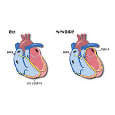 간호학 심장장애 객관적자료 맥박종류 심음종류 혈압맥압 경정맥압 대상자사정