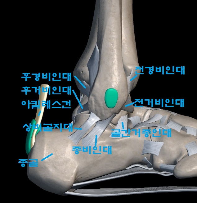 발목염좌, 발목손상 - 내번손상 전거비인대 종비인대 후거비인대 등의 손상