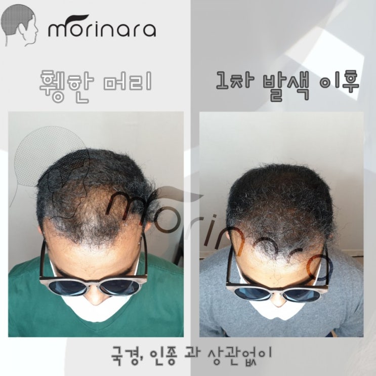  피부색에 상관없이 모두가 웃는 나라, MORINARA
