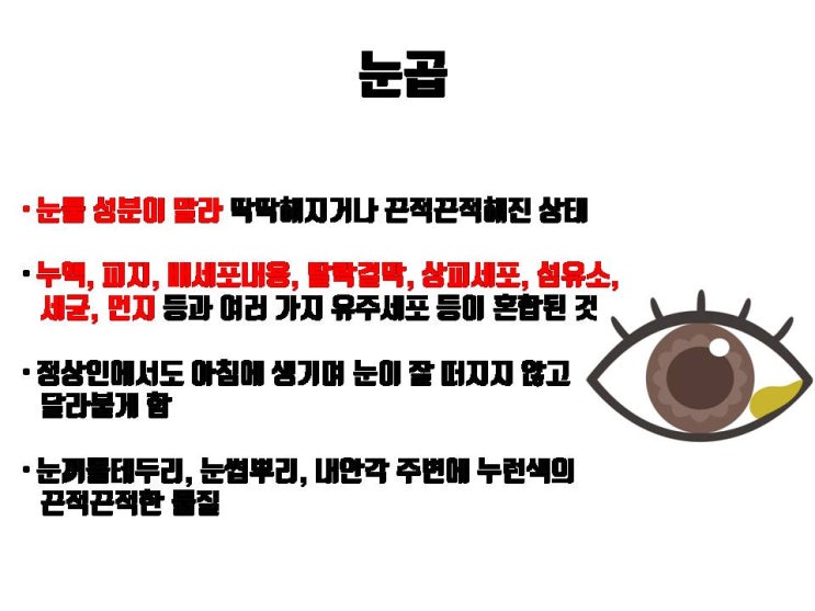  쌍수 후 눈곱으로 인해 눈이 안 떠져요? 쌍수 염증, 쌍수 부작용인가요?