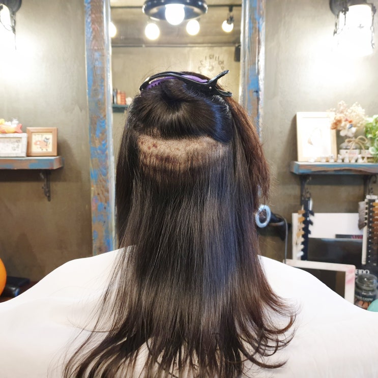  여자 정수리 가발 계속 써도 되나요?