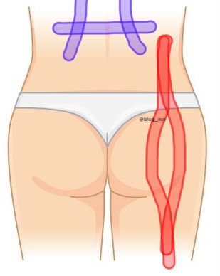 [임신31주차] 허리엉덩이골반 통증/다리가 저린 증상/환도선다/원인완화법/근육테이핑/스트레칭/운동 추천