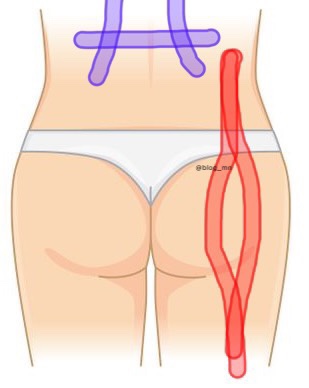  [임신31주차] 허리엉덩이골반 통증/다리가 저린 증상/환도선다/원인완화법/근육테이핑/스트레칭/운동 추천