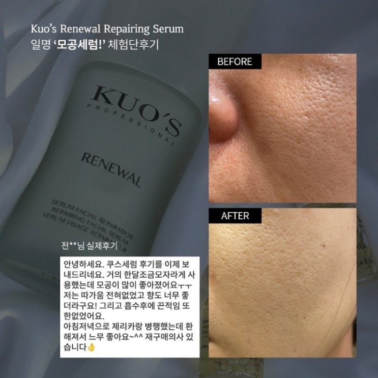  모공+요철 피부엔 무조건, 무조건이요️ “쿠스 모공세럼” 핫딜 진행 중