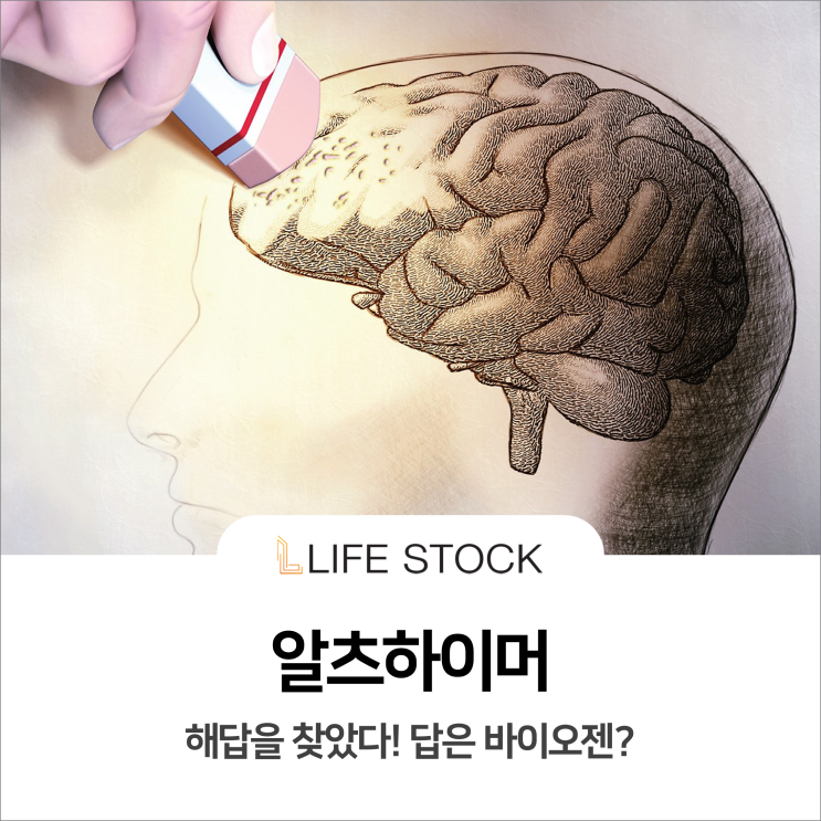  알츠하이머, 해답은 바이오젠? (feat.관련주)