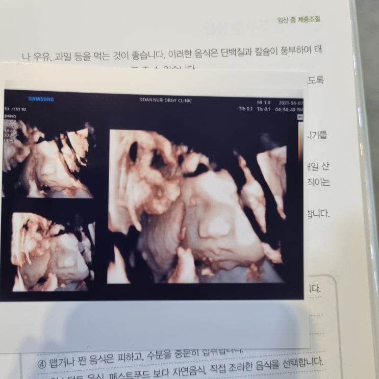  [둘째 임신] 임신 9개월 35주 증상 / 배크기 / 몸무게 / 막달검사 / 역아탈출실패 / 임신사진