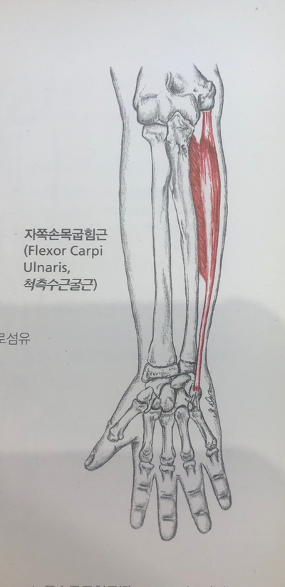 손목 바깥쪽 통증, 엄지통증 청라손목