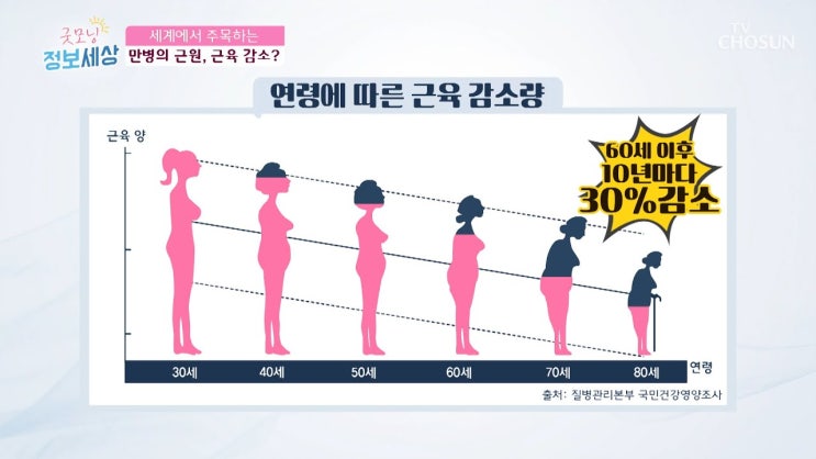  노년기 근육량 감소는 질병입니다.