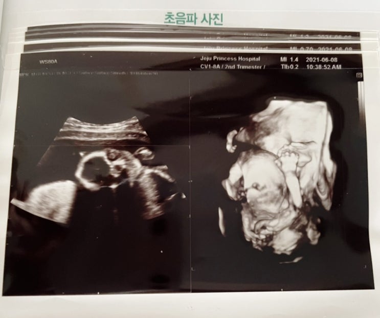  제인의 일상 - 임신 19주 / 임신 5개월 임산부 일상 / 배뭉침 / 태동 / 식욕 / 임신중기
