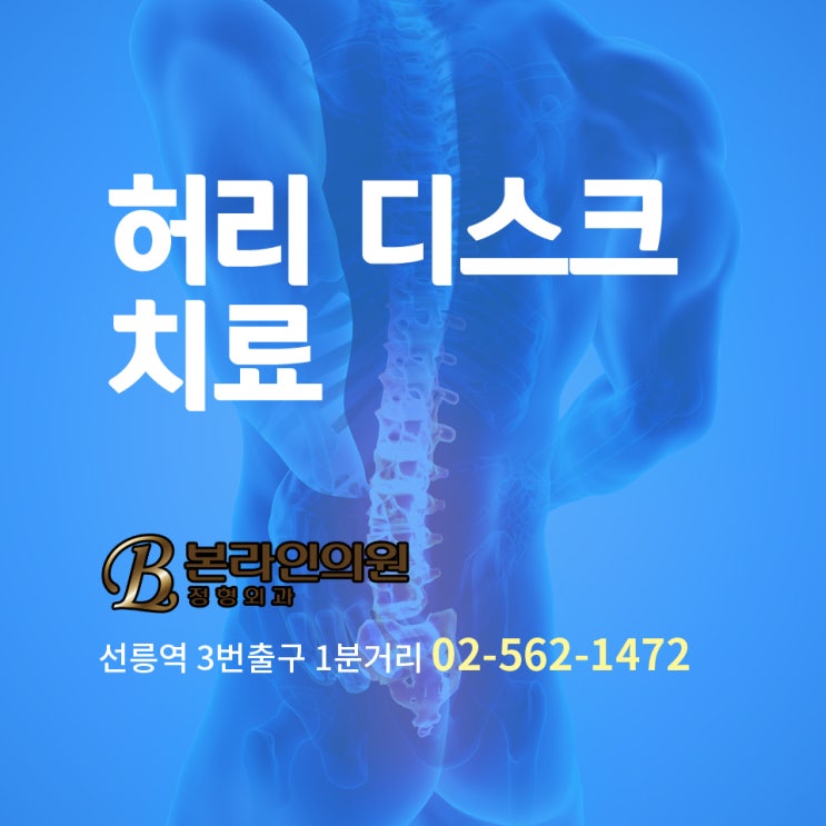  강남정형외과 허리디스크 치료 잘하는 곳
