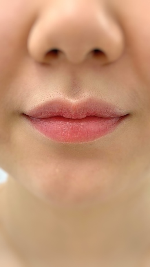  핏기없고 하얀입술 강남 틴트입술문신 잘 하는 곳!