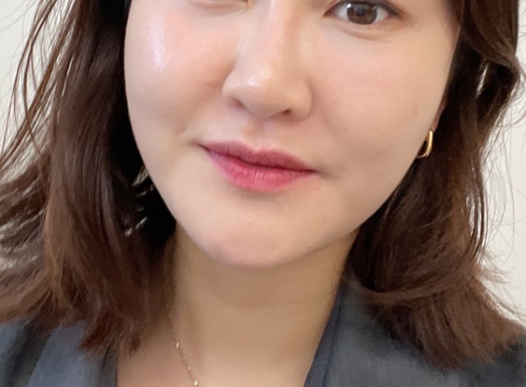  에스테필 시술 3주 차 후기 @청담동피부과