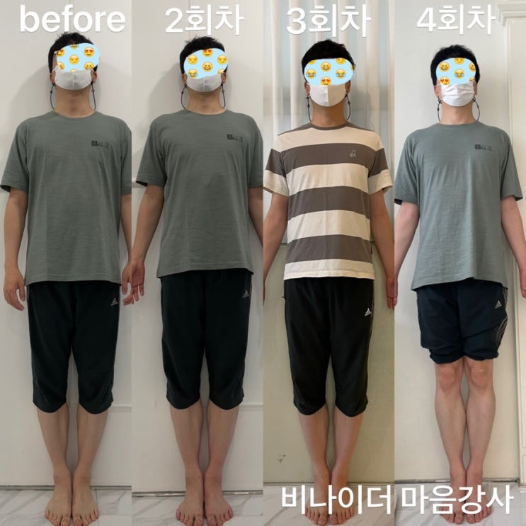  (망포비나이더/수원필라테스 / 망포필라테스)비나이더필라테스 & PT 개인필라 회원님 체형교정 전후 과정