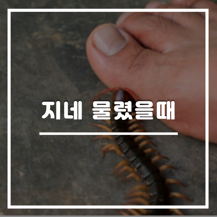  지네 물렸을때 증상 및 응급조치 : 대처 방법 이렇게만 하세요