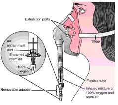 기본간호학 산소요법목적 마스크종류특징 가습기 oxygentherapy 저산소증호흡곤란주의사항