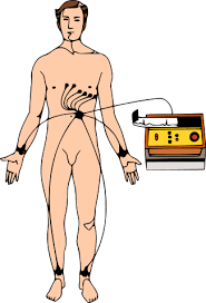 심전도EKG사용법 파형의미해석 벤틸레이터VENTILATION사용법 모드타입 세팅방법 심전도EKG사용법 파형의미해석 벤틸레이터VENTILATION사용법 모드타입 세팅방법
