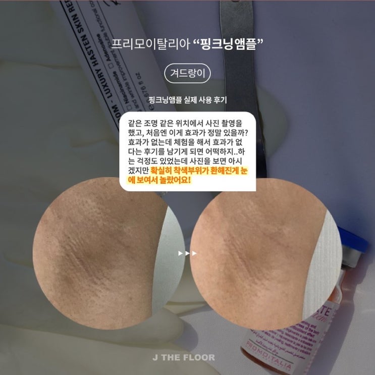  나만 알고싶은 앰플 ! 핑크닝 앰플 오늘이 마지막 기회 / 겨드랑이 착색 / 와이존 착색