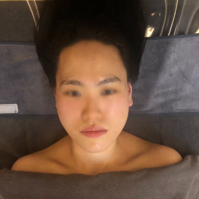 새라본 안양점 : 범계 피부관리 작은얼굴 관리 후기 5