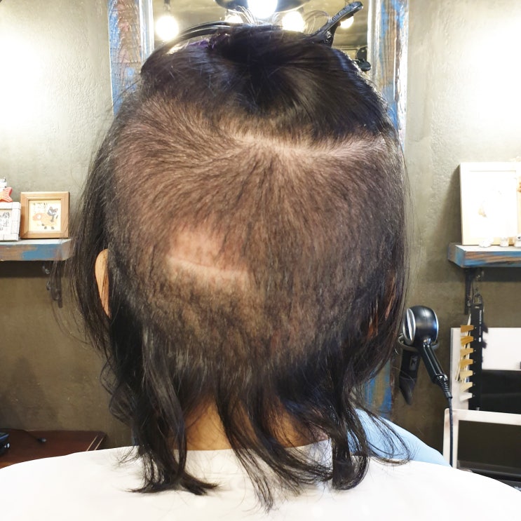  여자부분가발 쓰면 어떤가요?