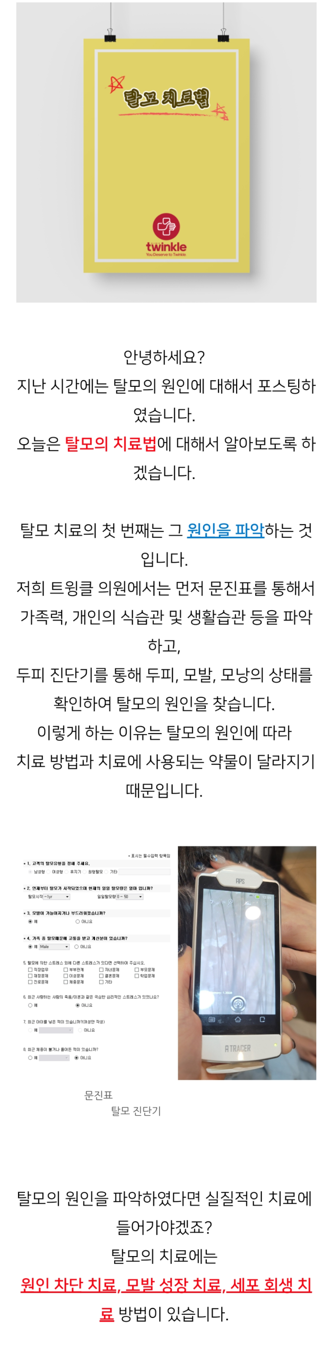  광화문 피부과, 탈모 개선 방법은?