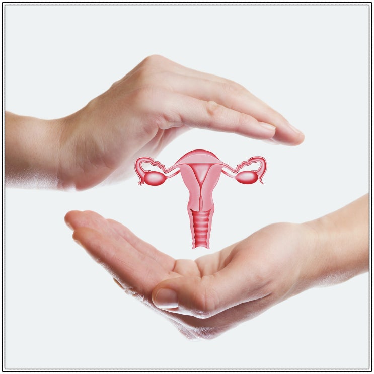  자궁근종제거? 수술만이 답이라고 생각하는 분은 보세요.