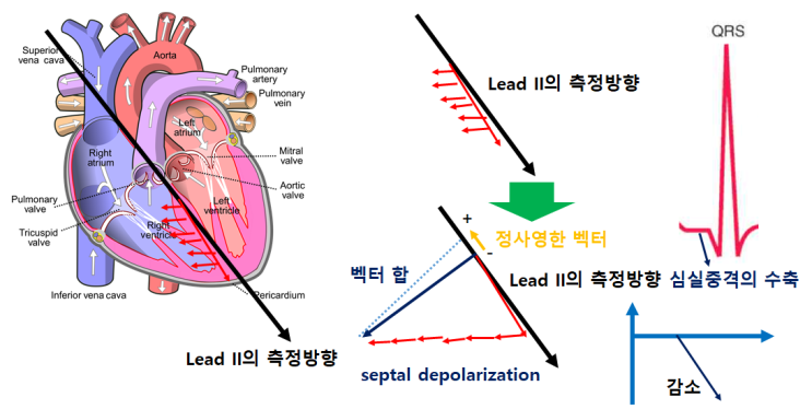  의학에서 활용되는 수학 (2) - 심전도(EKG)와 벡터