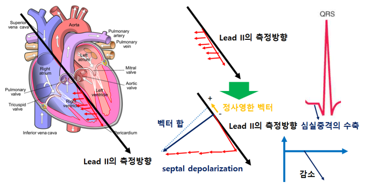 의학에서 활용되는 수학 (2) - 심전도(EKG)와 벡터