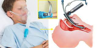 응급실 emergency kit 기관내삽관순서 airway사용법 후두경튜브 구강내삽관 응급실 emergency kit 기관내삽관순서 airway사용법 후두경튜브 구강내삽관