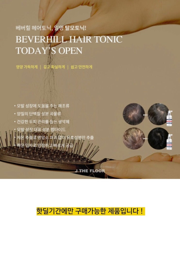  탈모 고민만 하고있지 마세요! "베버힐 탈모토닉 OPEN" 후기인증