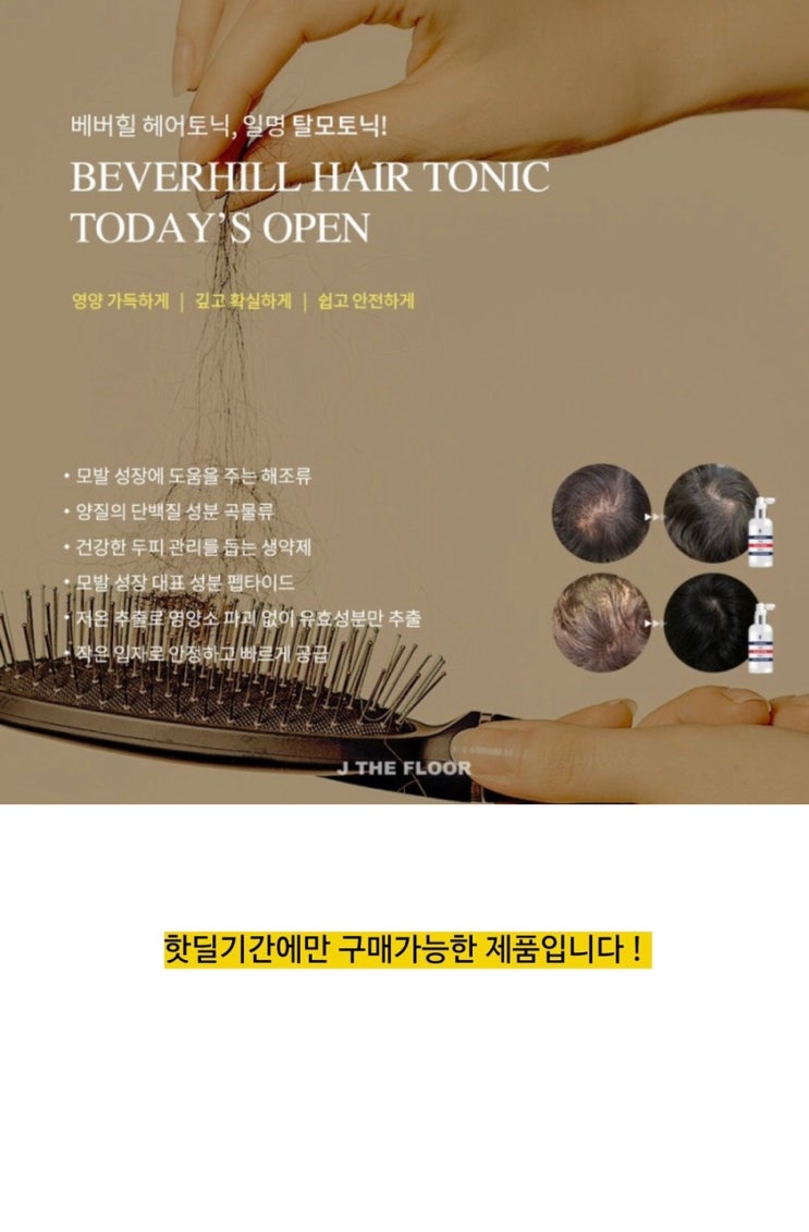 탈모 고민만 하고있지 마세요! "베버힐 탈모토닉 OPEN" 후기인증