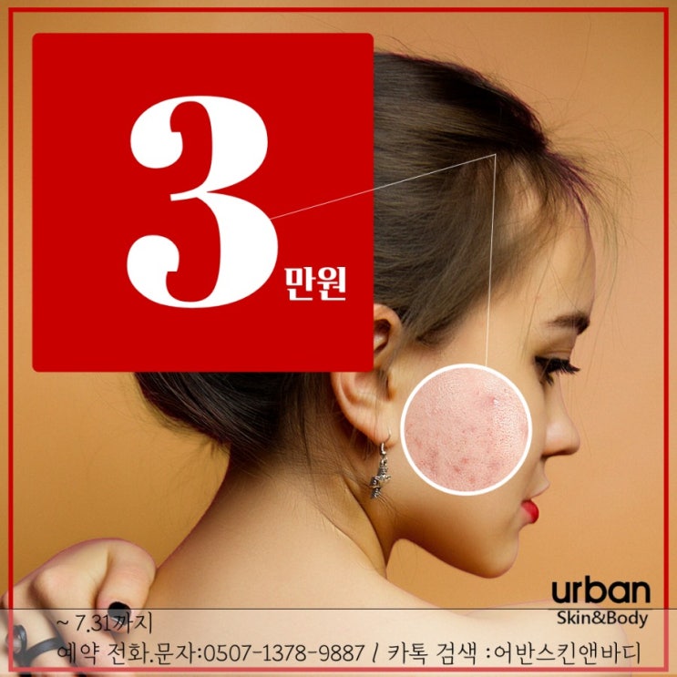  서면전포동피부관리실 어반스킨앤바디의 여드름시리즈 이벤트